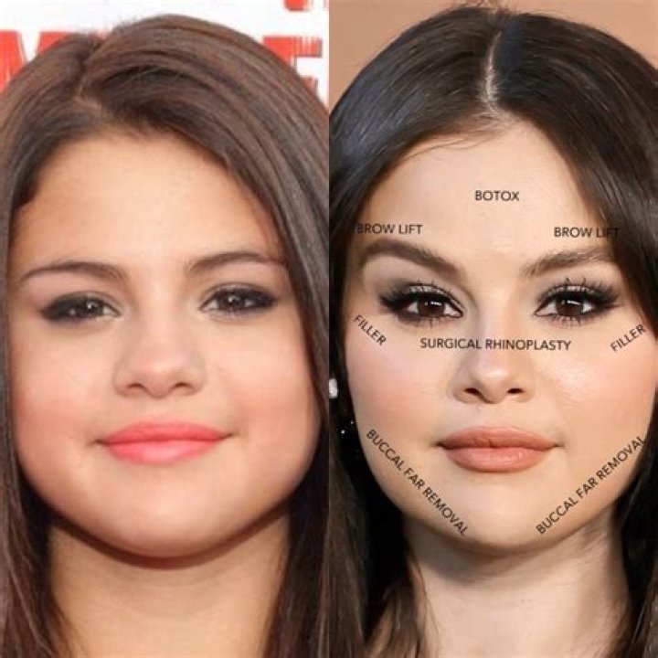Did Laura Kightlinger Undergo Plastic Surgery, Why Does Her Face Look So Different?