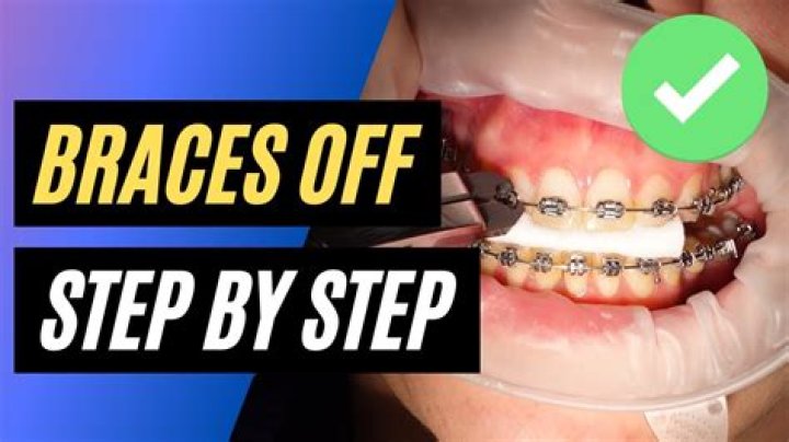 How to remove braces glue